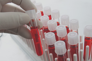 How to lower adrenaline