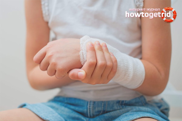 How to get rid of burn marks