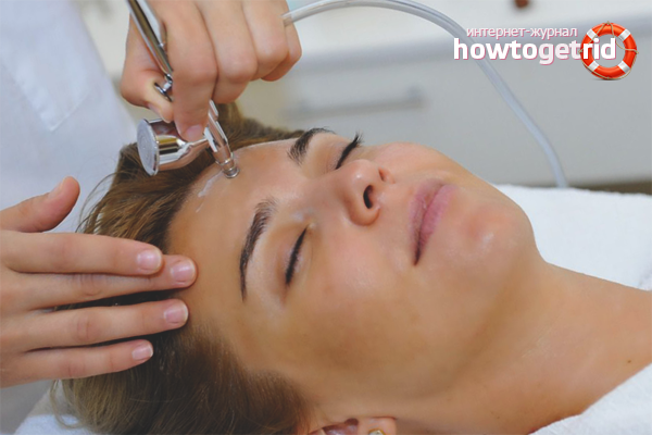 Acne cosmetic treatments