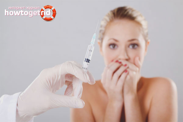 Botox for underarm sweating