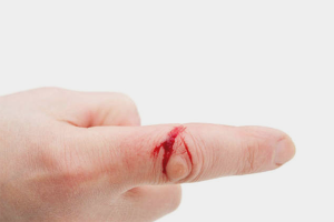 How to stop blood when cut