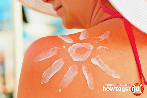 How to remove redness after tanning