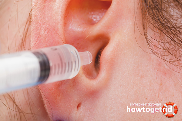 How to rinse an ear from a sulfuric stopper