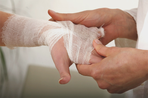 How to treat a burn from boiling water