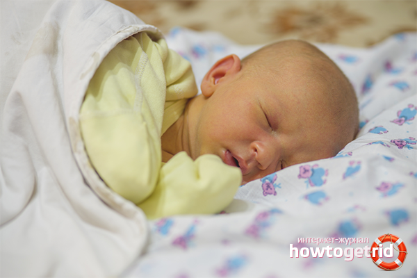 Varieties of jaundice