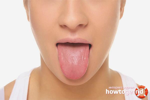How to treat acne in the tongue