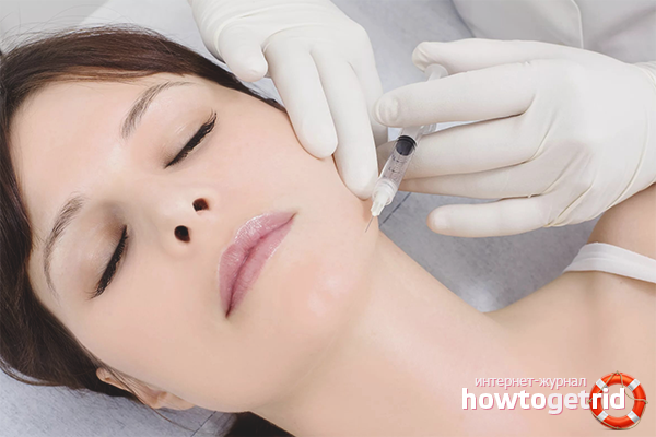 Professional neck rejuvenation