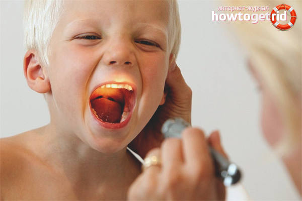 How to cure a red throat in a child