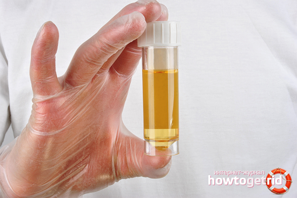 Acetone in the urine of a child