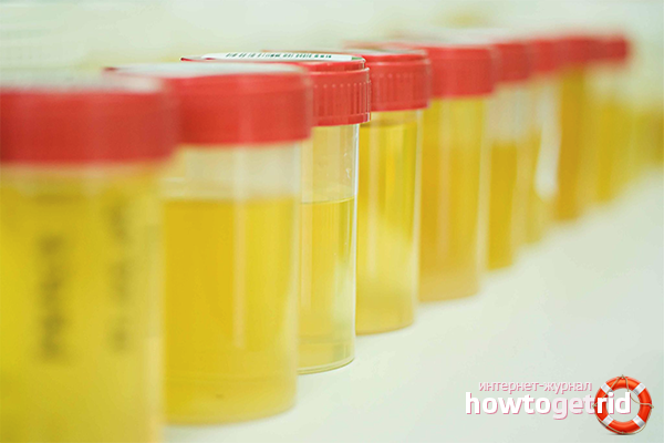 Pathological causes of increased levels of acetone in the body