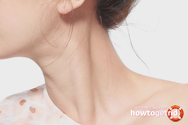 How to remove the rings of Venus on the neck