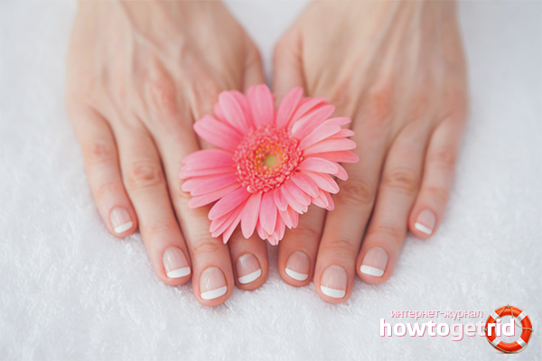 Folk remedies in the fight against fungus on the hands