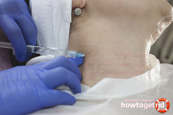 Professional services from Venus rings on the neck