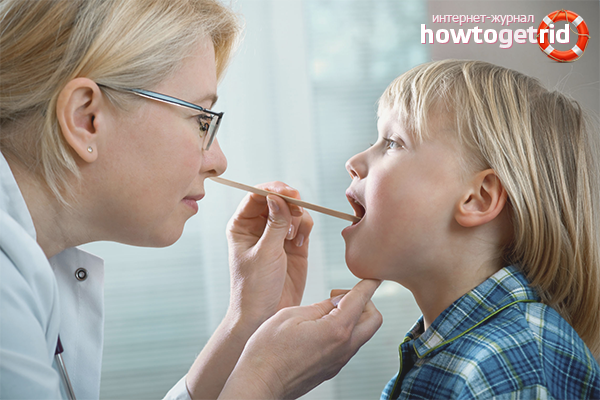 Adenoids in children