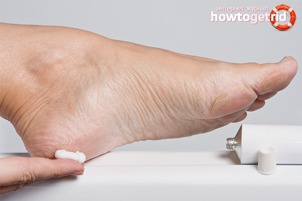 Comprehensive treatment of heel spurs