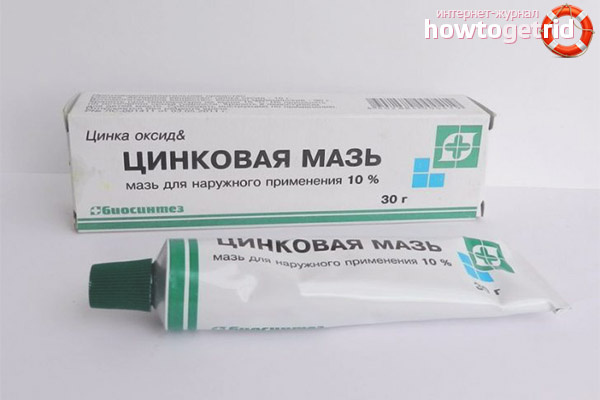 Zinc Chin Acne Ointment